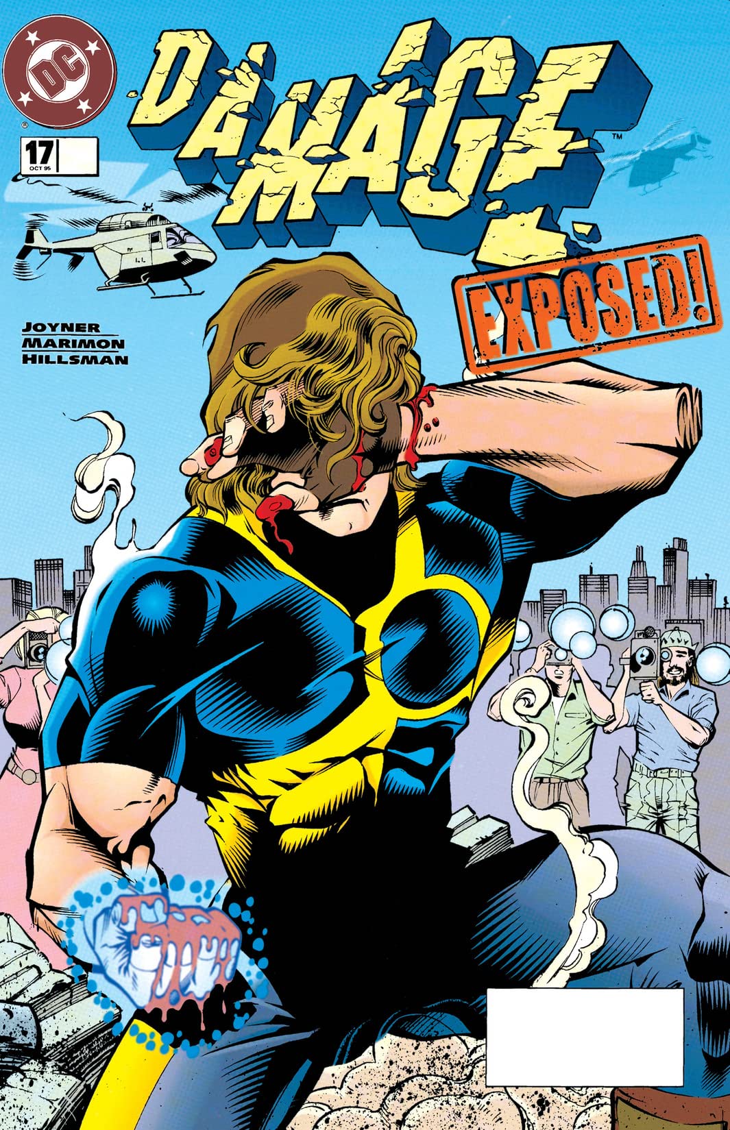 #17