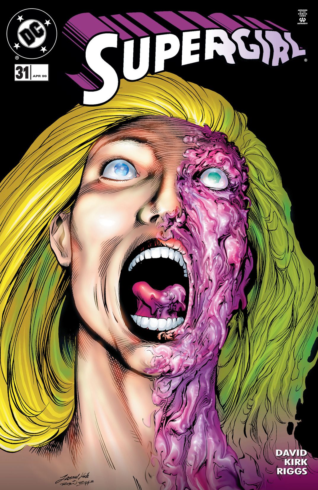 #31